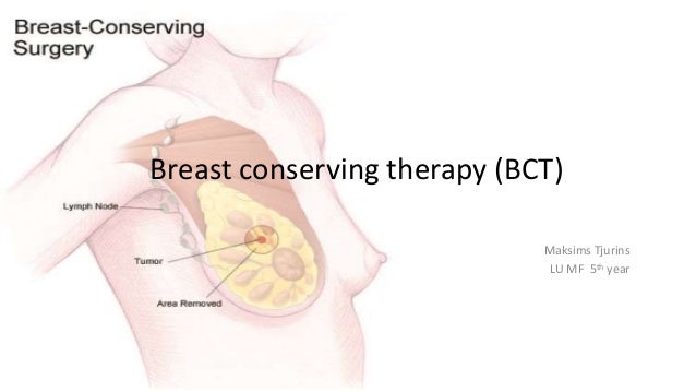 breast conservation therapy Breast conservation therapy